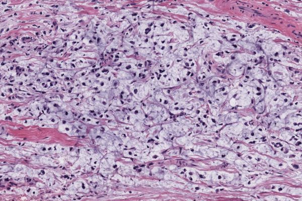 Gipath 2