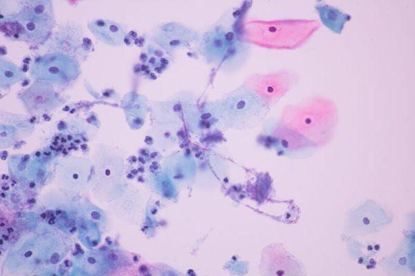 Gyn Cytology Module 1