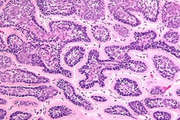 Skin Pathology